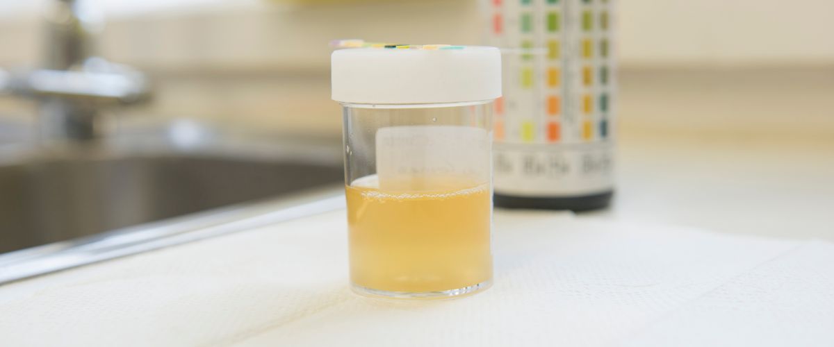 Diferencias con la creatinuria en muestra aislada