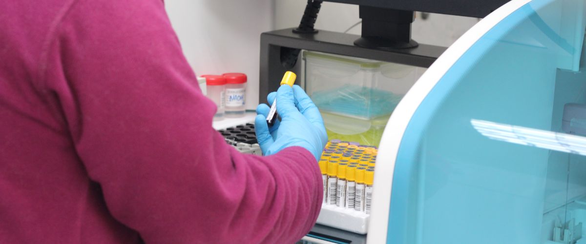 ¿Para qué sirve el análisis de creatinuria en orina de 24 horas